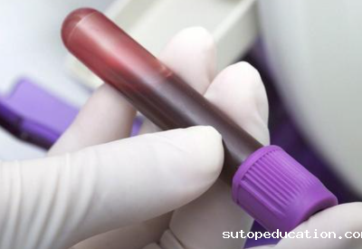 微量元素测试仪介绍铅中毒危害